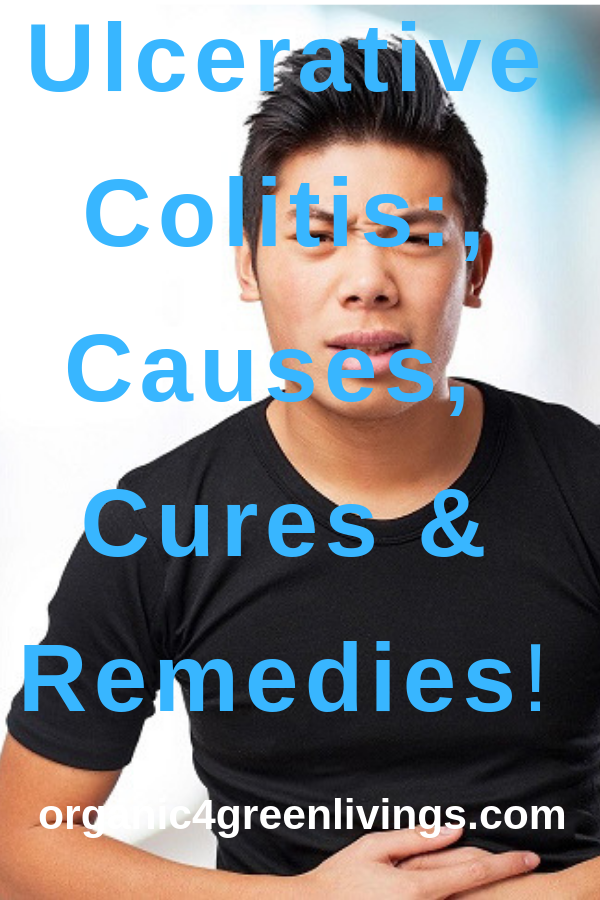 Ulcerative Colitis 
