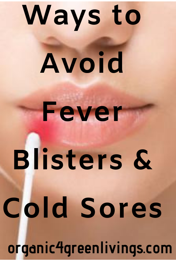 Ways to Avoid Cold Sores